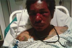 Man Gets Shot by Police, Fought With Them Nearly 2 Weeks Prior