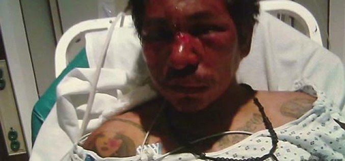 Man Gets Shot by Police, Fought With Them Nearly 2 Weeks Prior